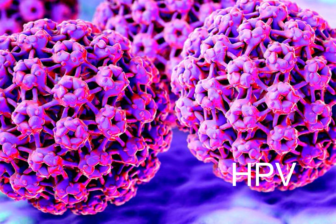 hpv-proiect-oncoprev.jpg